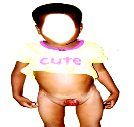 H-E-L-P,  Girl, 3, with bladder outside her body begs for a  lifeline