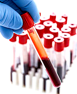Senate wants Genotype as compulsory test for couples before marriage