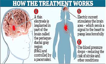 How human Brain can be rewired – Expert