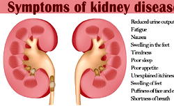 Abuse of pain killers could damage kidney – Pharmacist