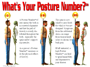 BAD POSTURE: Worse than a bad temper