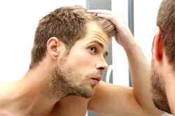 9 ways to save a receding hairline