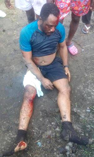 Medical doctor knocked down while jogging in Lagos
