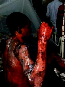 Photos: Woman pours hot water on husband for marrying another wife