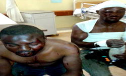 Badoo: Another suspect set ablaze in Ikorodu