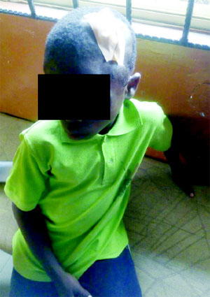 Nail-in-the-head boy: Suspect yet to be prosecuted