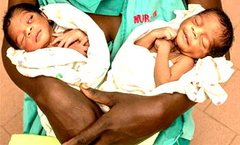 Africa’s new born twins at risk