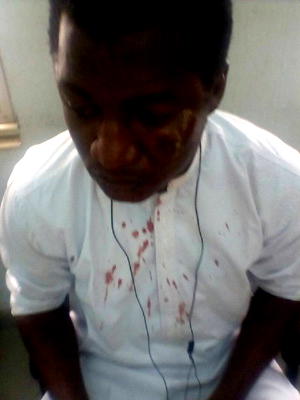 Photos: Journalist attacked by protester at Wuse market