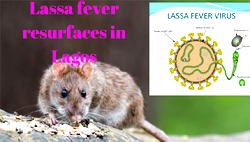 FCT records fresh case of Lassa fever