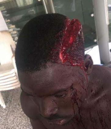 Graphic photos: Ojobo community clash