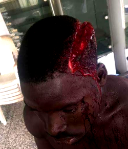 Graphic photos: Ojobo community clash