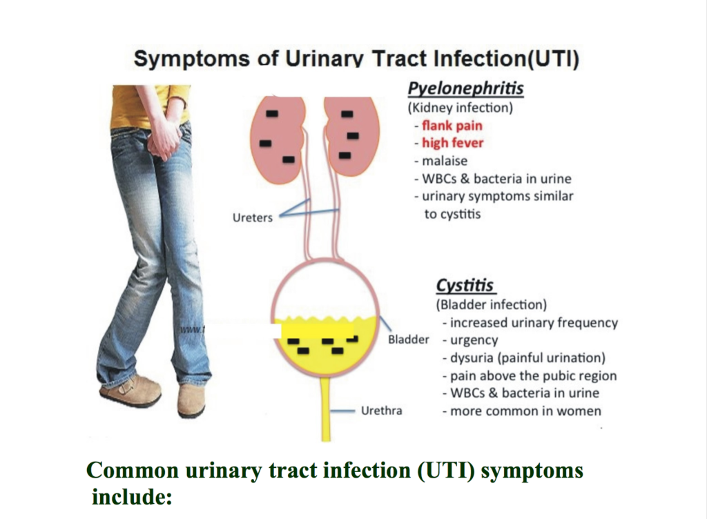 Occasional Yeast In Urine