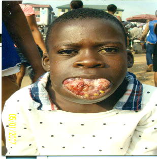 Akishi seeks 4.1m for jaw surgery