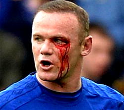 Five unusual injuries