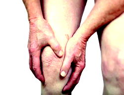 Experts worry over silent emergency of rheumatoid arthritis