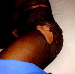 Housewife pushes sister in-law into pot of boiling  water