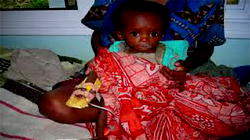 Okoba donates N10m equipment to tackle sickle cell in Delta