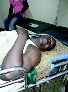 •One of the injured Ogbe-Ijoh villagers