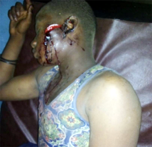 Poisonous tubers on grazing routes: 10 injured as herdsmen, farmers clash in Oyo