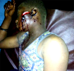 Poisonous tubers on grazing routes: 10 injured as herdsmen, farmers clash in Oyo