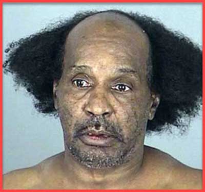 Abuja Man Exposes How He Re Grow His Hair Naturally Cure Baldness