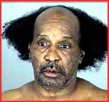 Abuja Man Exposes How He Re-grow His Hair Naturally, Cure Baldness and Severe Hair L0ss within 14 days using a Natural Herbal Remedy