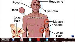Understanding Typhoid fever