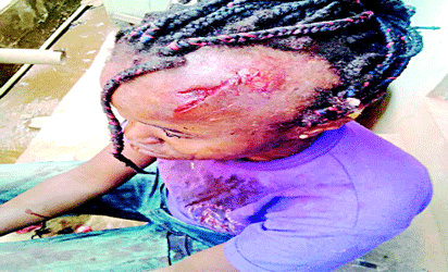 Herdsman attacks Ondo woman in her farm