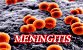 Nigeria faces meningitis outbreak with 151 deaths 1,826 suspected cases