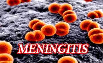 meningitis
