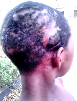 Madam inserts sticks into private part of 12-year-old maid