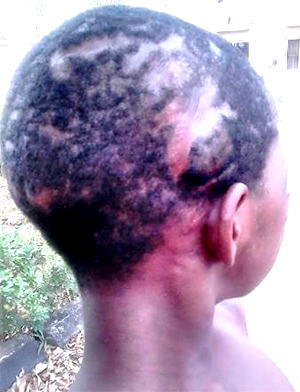 Madam inserts sticks into private part of 12-year-old maid