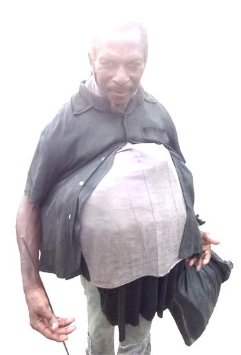 I am blind, not mad — Calabar beggar who says his mates are police commissioners 