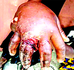 10-yr-old maid with rotting hand rescued from Lagos couple