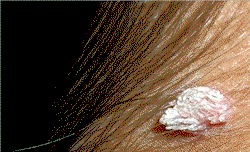 Excessive make-up linked to skin cancer–Dermatologist