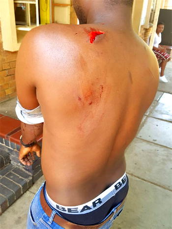 Xenophobia: Nigerian stabbed in South Africa