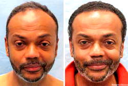 How To Cure Baldness, Stop Hair Loss and Re-grow Hair using a Natural Herbal Therapy That Works Almost Immediately… Even If Everything Else You Have Tried Has Failed!