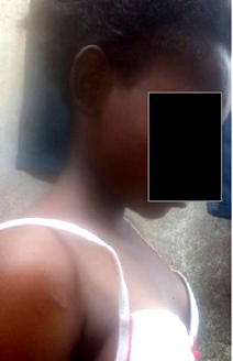 How I was almost set ablaze over alleged theft of N16,000 — 15-yr-old girl