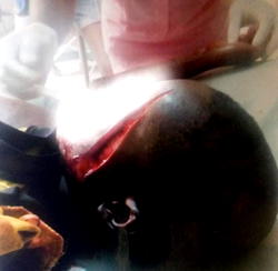 Fight over Easter chicken’s droppings: Landlady slices 12-yr-old boy, mother with razor blade in Delta