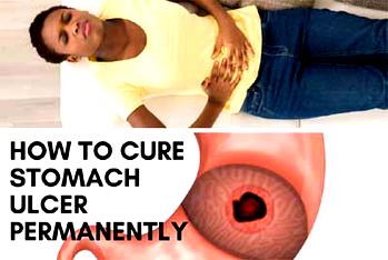  Stomach Ulcer Cure: This Solution Will Cure Your Stomach Ulcer Permanently