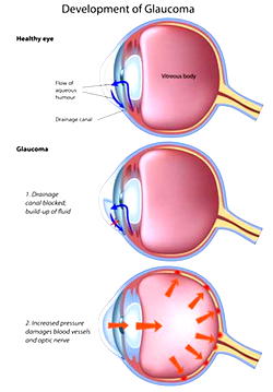Proper eye care, a must for children–ophthalmologist