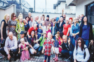 Persons with albinism suffer most discrimination in public spaces ― Survey