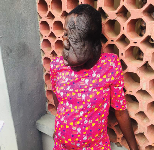Pregnant and deformed, fake NGO made money by using me to beg for alms for 3 years – Tina