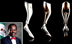 Workplace Accident: NSITF gave 42 artificial limbs in 12 months to those who lost their limbs
