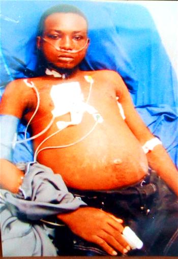 Bathlowme, 22, seeks N10.5m for kidney transplant