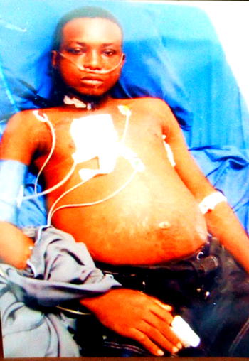 Bathlowme, 22, seeks N10.5m for kidney transplant
