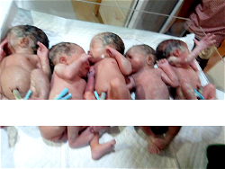 Woman gives birth to quintuplets in Awka