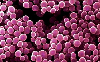 Staphylococcus not sexually transmitted, vital for women – doctor