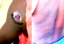 I burnt the shoulder of my house-help, 8, left her with 8 stitches — Nursing mother
