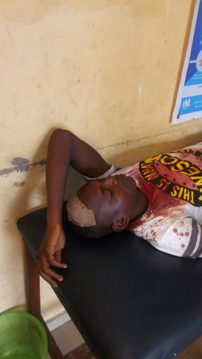 Herdsmen invade Onokpasa’s compound, maim son